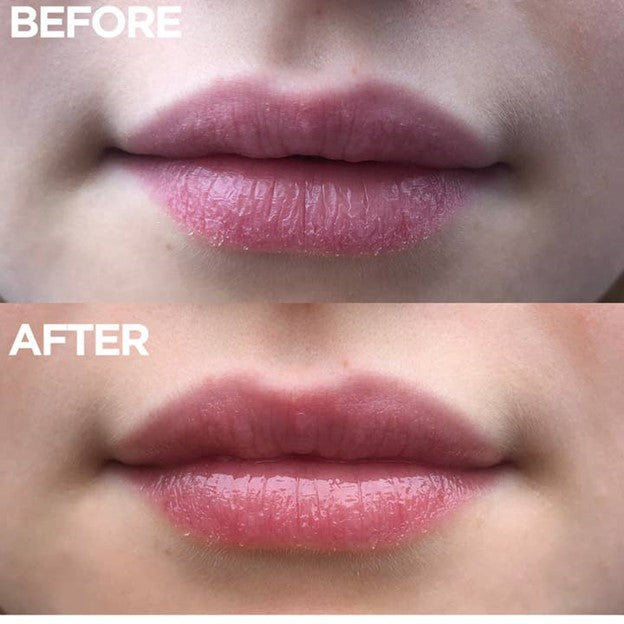 the original 101 ointment multipurpose superbalm